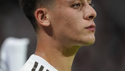 姆巴佩伤情牵动皇马与法国队：他能否撑过赛季关键时刻？